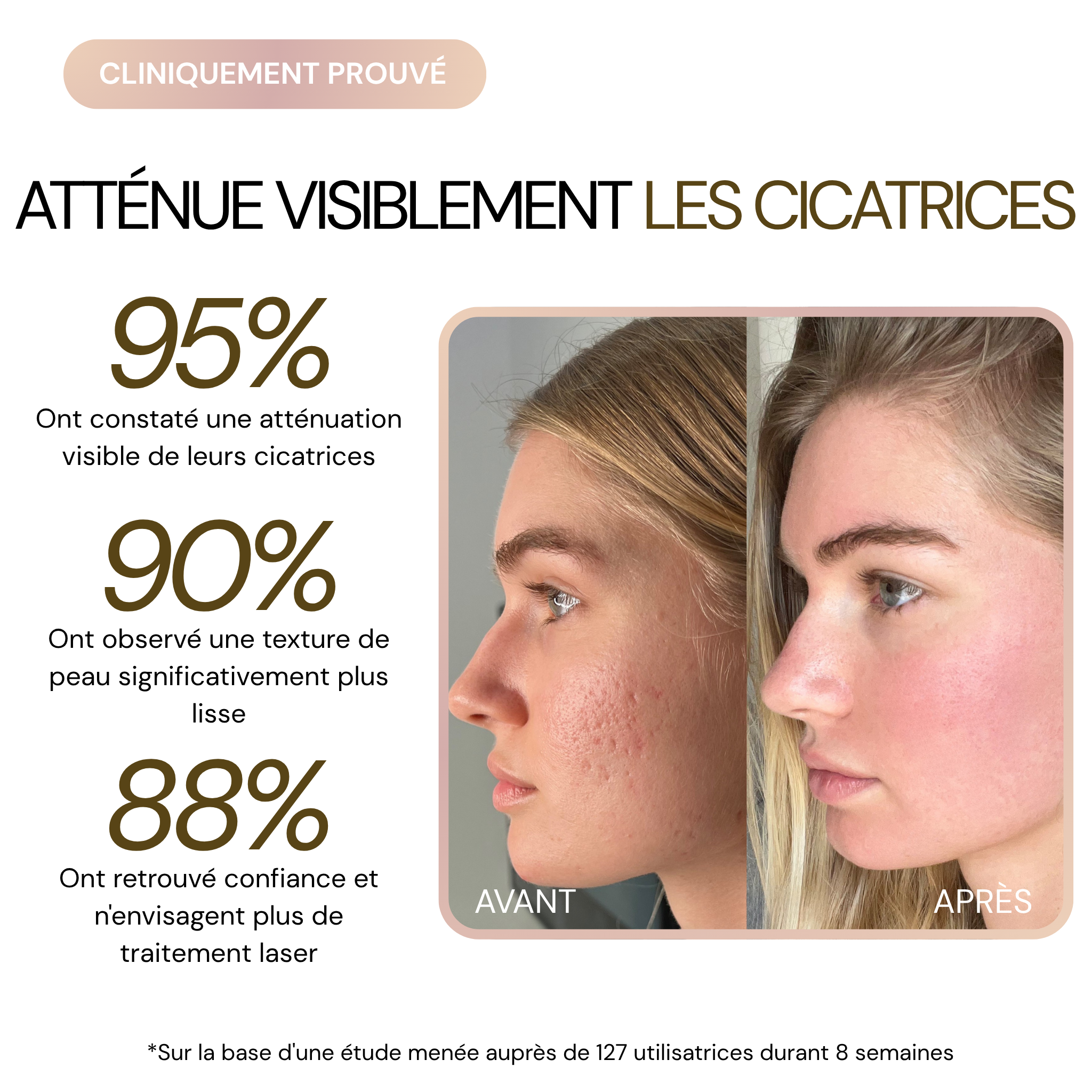 UnicYou - Stick DermaRepair Acné