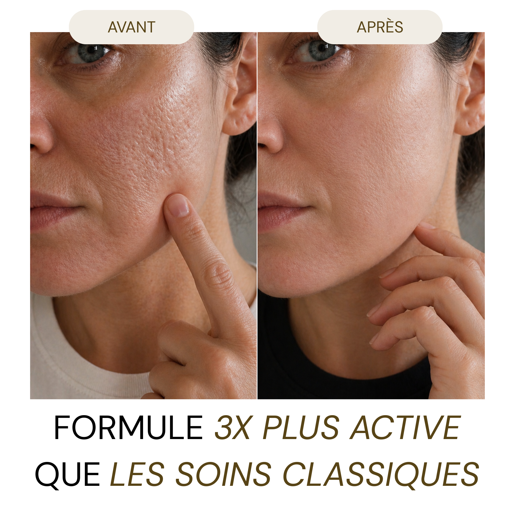 UnicYou - Stick DermaRepair Acné